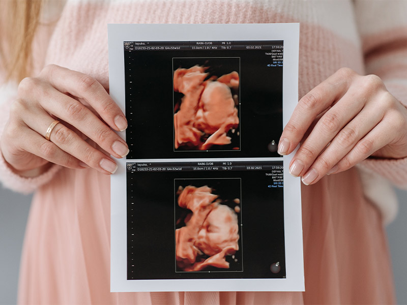 Schwangere hält Ultraschallbild zur Entwicklung des Embryos.