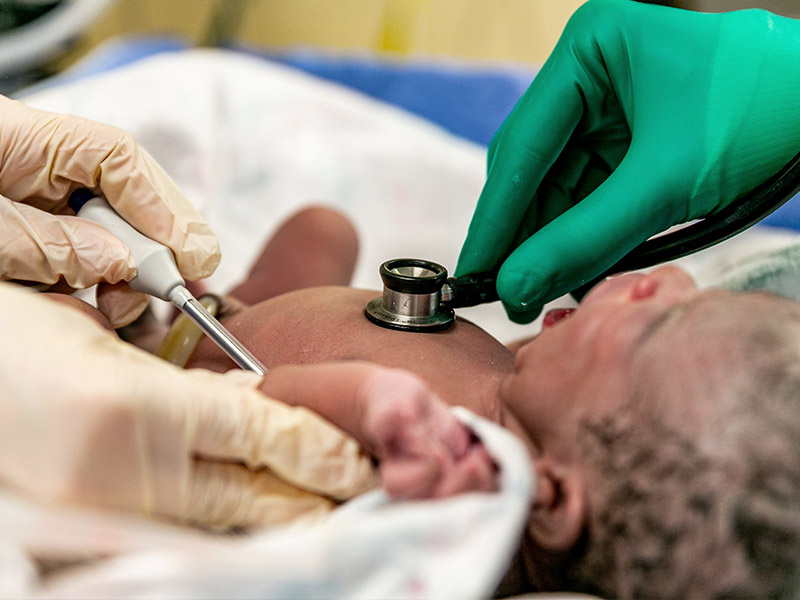 Neugeborenes wird nach Kaiserschnitt von Ärzten untersucht