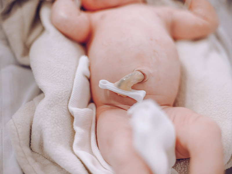 Baby mit abgeschnittenem Bauchnabel nach Geburt